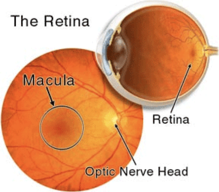 Retina